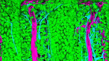 SunJin Lab, RapiClear 1.52: 3D Architecture of Human Colon