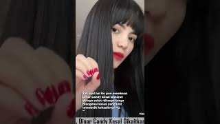 Ko Apex Terjerat Kasus Hukum, Dinar Candy Kesal Dikaitkan dengan Masalah sang Kekasih