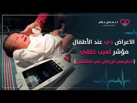 قسطرة القلب حل أي عيب خلقي في القلب دكتور سامح علام