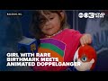 Macon girl with a rare birthmark meets her animated doppelganger