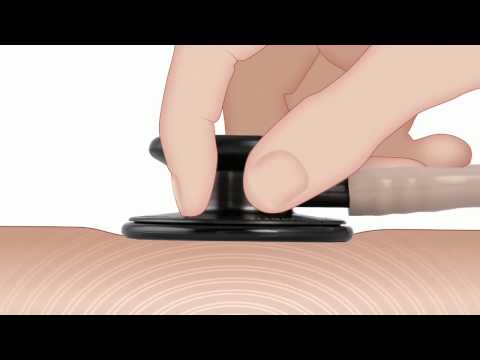 Видео: Как да разбиете стетоскоп със сейф?