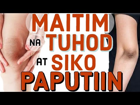 Video: Paano Tratuhin ang Eczema (may Mga Larawan)