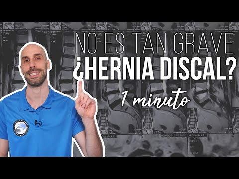 Video: Cómo diagnosticar una hernia de disco (con imágenes)