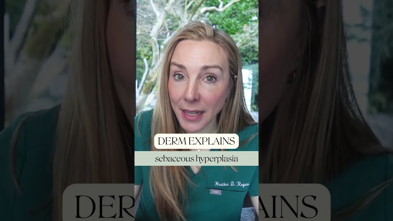Derm Explains: Sebaceous Hyperplasia