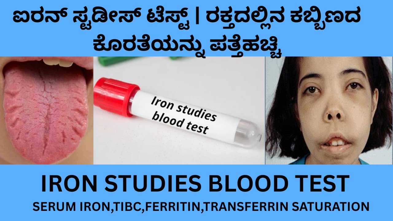 IRON STUDIES BLOOD TEST IN KANNADA.SERUM IRON  FERRITIN TIBC AND TRANSFERRIN SATURATION IN KANNADA.