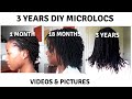 3 YEARS MICROLOCS JOURNEY | VIDEOS AND PICTURES | FENETI