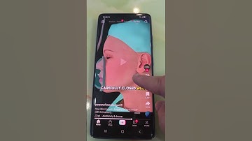 Hèn chi cái đường mổ căng da mặt lạ như vậy