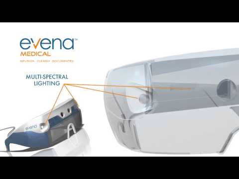 Evena Medical Eyes On