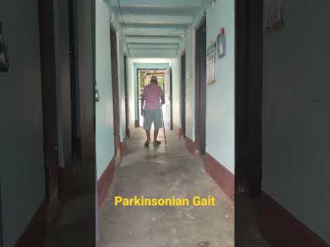 Parkinsonian Gait - Parkinsons Disease @DentCareNepal