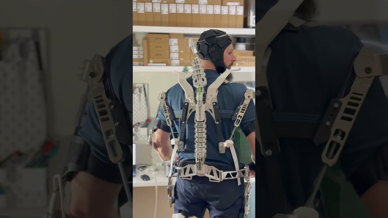 Дополнительные улучшения металлических элементов благодаря 