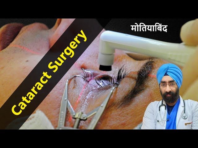 कैसे होती है Cataract Surgery मोतियाबिंद | Changing Eye Lens | Dr.Education