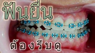 LET ME IN THAILAND SEASON2 | Ep.05 สาวฟันยื่น | 3 ธ.ค. 59 Full HD