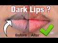 Extremely dark lips diy package dark to light overnight skinbleachingsamanthaaa cabey