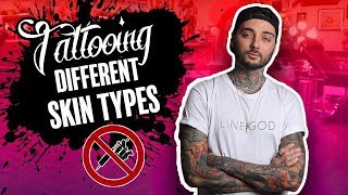 TATTOOING Different SKIN Types : Self Harm Scars, Allergies, Skin Tones + MORE!!