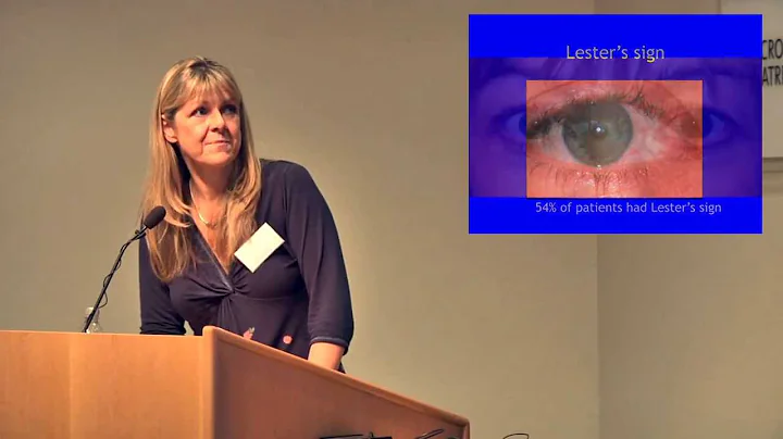 Nail Patella Syndrome - Presentation by Dr. Elizab...