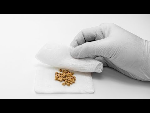 Wideo: ❶ Jak Leczyć Kamicę żółciową