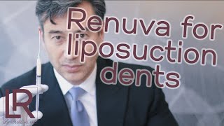 Renuva Fills In Dents from Liposuction | Dr. Leif Rogers