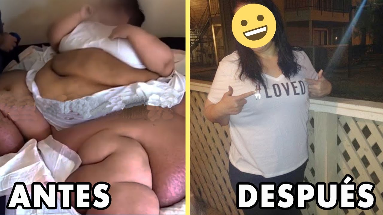 Una mujer pesaba 470 kilos, pero cuando veas cómo luce ahora quedarás asombrado