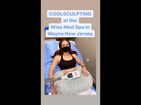 My COOLSCULPTING Experience