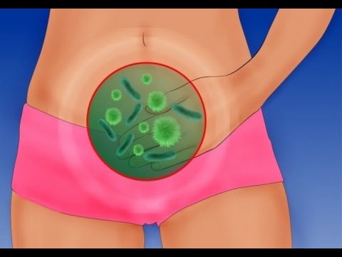 como quitar la comezon en los genitales femeninos