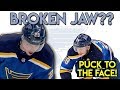 Vince Dunn Takes HOCKEY PUCK to the FACE | Doctor Reacts to Injury