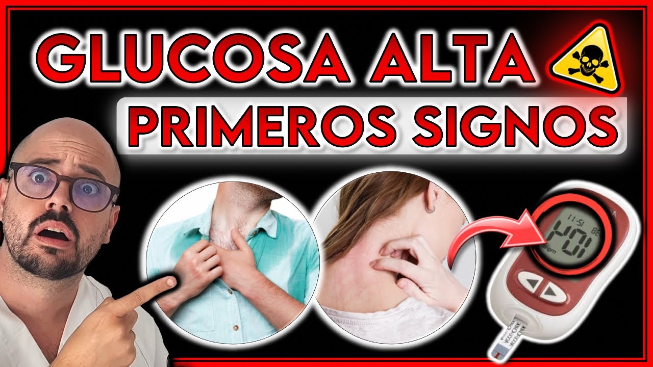 ¡9 SÍNTOMAS que AVISAN de GLUCOSA ALTA! || ¿TIENES una DIABETES? - YouTube