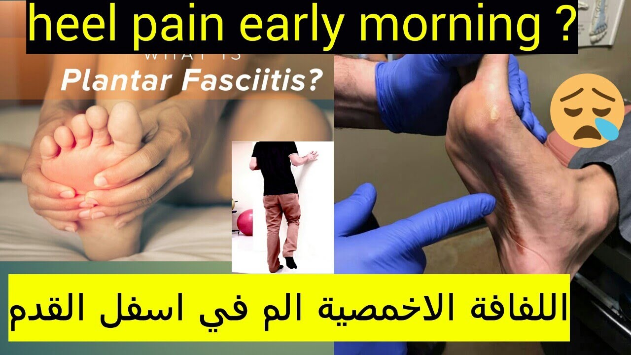 Basic exercises for plantar fasciitis part 1 تمارين التهاب اللفافة