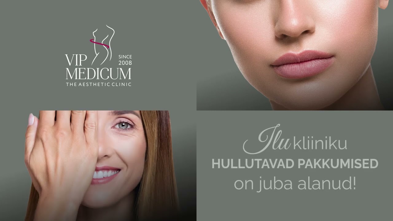 Hullutavad pakkumised on alanud!