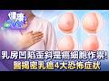 乳癌年齡下探30歲...乳房凹陷歪斜是「癌細胞在作祟」！醫揭密乳癌4大恐怖症狀【57健康同學會】