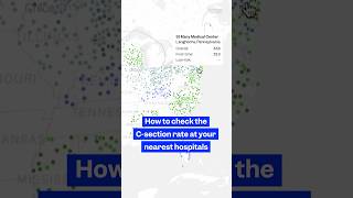 #Hospitals just miles apart can have drastically different C-section #rates — here's why.
