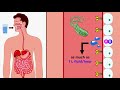 Cholera vibrio cholerae o1 and o139