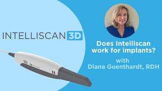 Intelliscan 3D FAQ - Does Intelliscan work for implants