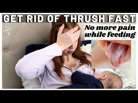Video: Nipple Thrush: Symptomer, årsager Og Behandling