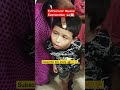 #esotropia#exotropia#eyemakeup #eyediseases #Squinteye#eyedoctor #love #shorts #viral#opthalmology