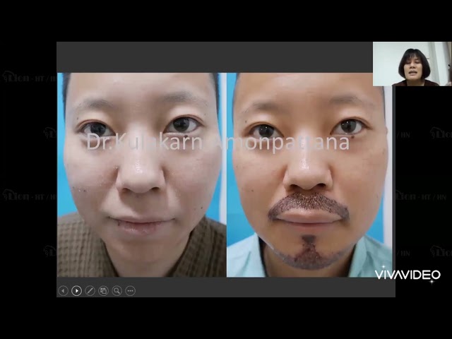 YouTube video player
