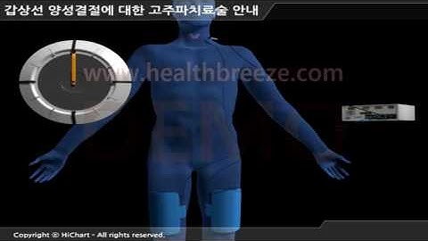 [시연용] c0075aako 갑상선 양성결절에 대한 고주파치료술 안내