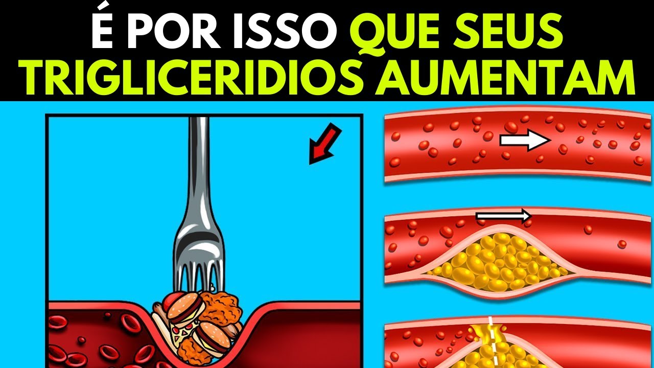 7 alimentos que aumentam os triglicerídeos e 3 que reduzem - YouTube