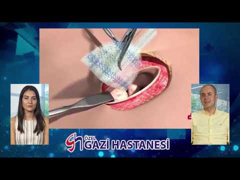 Karın Duvarı Fıtıkları - Op. Dr. Ahmet Önal - Gazi Hastanesi