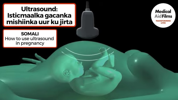 Erotik oyinchoqlarning qanday turlari mavjud? Yetuk porno mushuklar