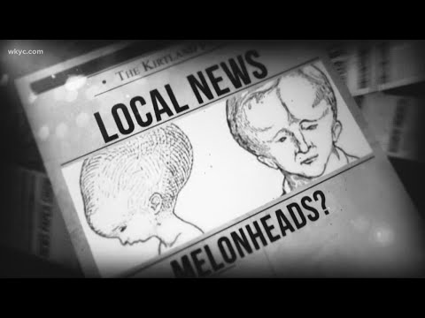 3News investigates the 'melon heads' of Kirtland
