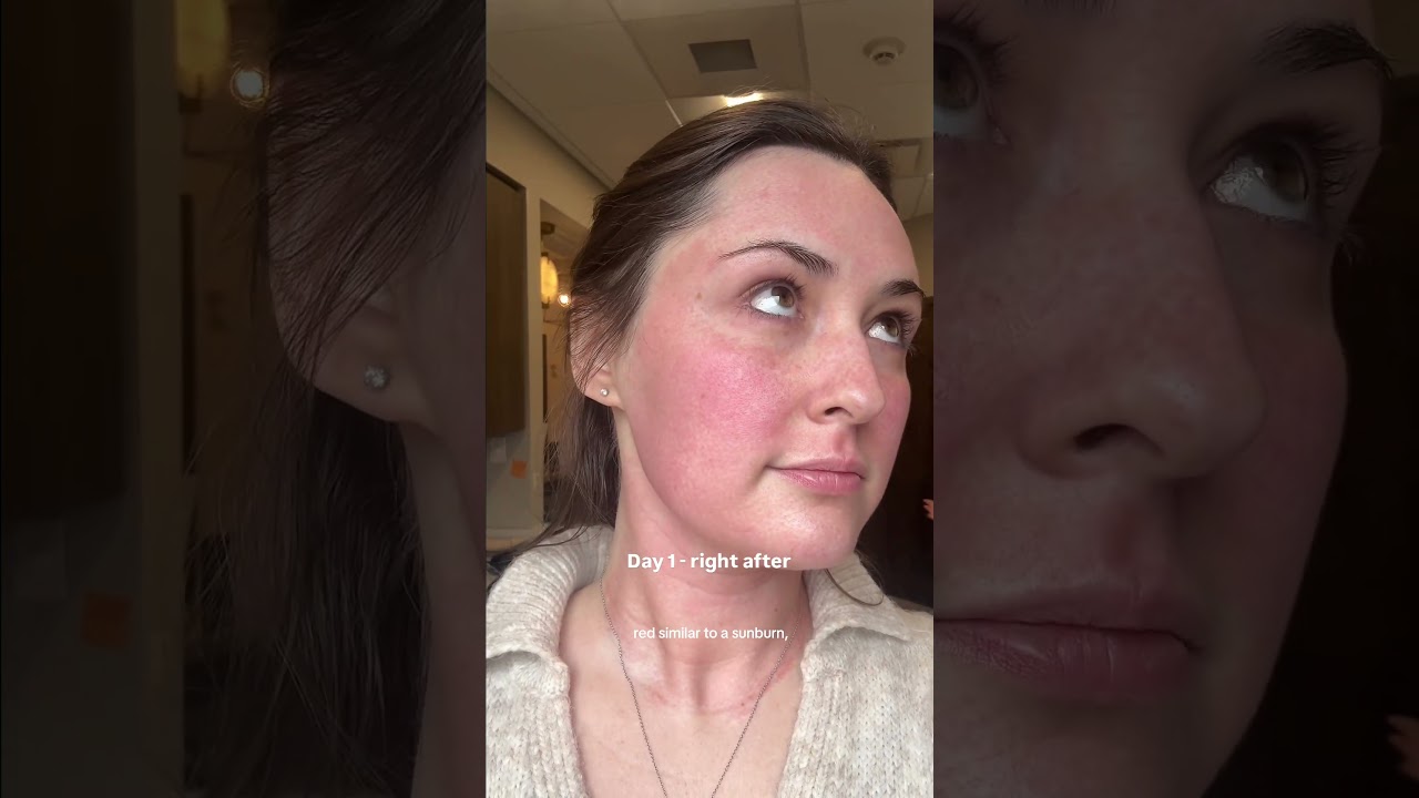 Reset your skin with Moxi ✨