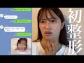 整形大反対する母親に「整形してきた」と話したら...