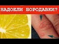 Как УДАЛИТЬ Бородавки При Помощи ЛИМОНА?