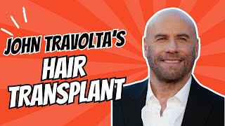 Famous John Travolta's Hair Transplant Journey Wealth