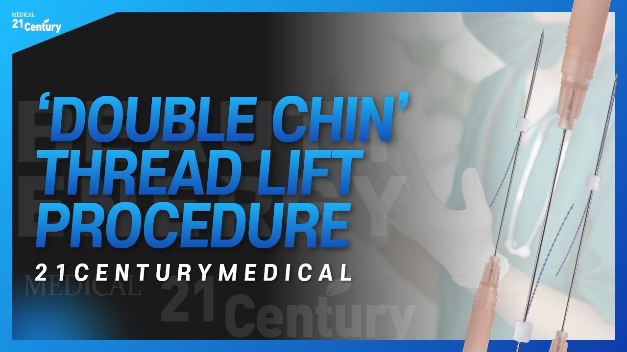 Double Chin Threading Thread Lift Procedure - Double Chin Thread | 21 Century Medical - YouTube