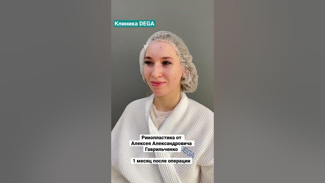 Клиника дега юсупова результаты фото Гаврильченко пластический хирург