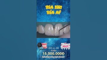 [3D] TRÁM RĂNG THẨM MỸ || Nha Khoa Quốc Tế Athena