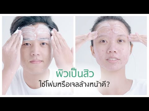 ผิวเป็นสิวควรเลือกใช้โฟมล้างหน้า หรือเจลล้างหน้า?