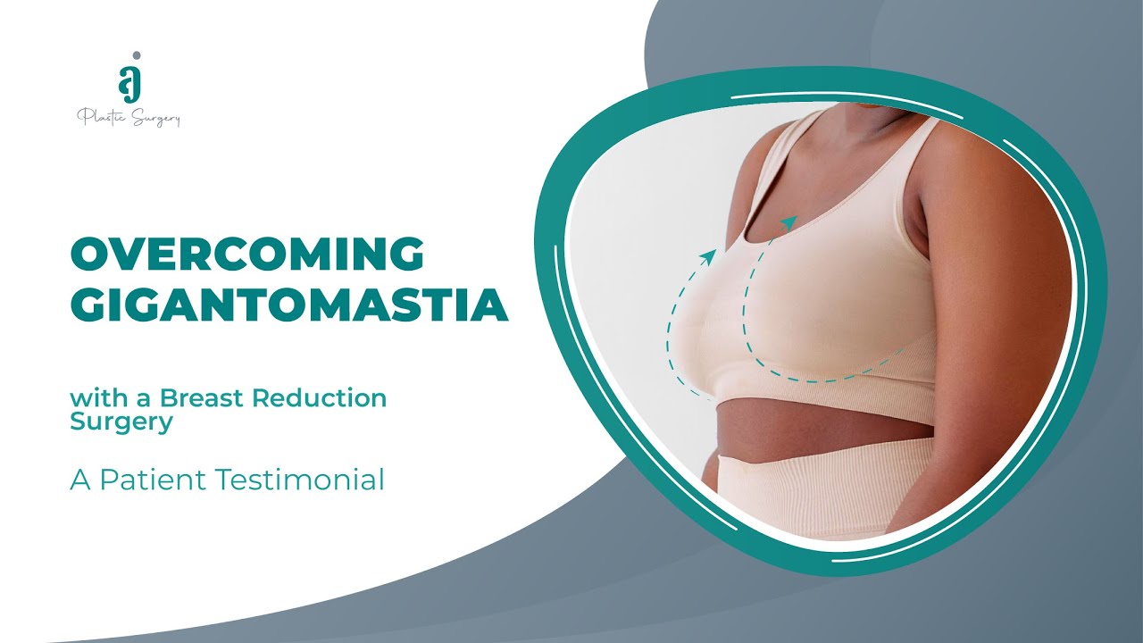 OVERCOMING GIGANTOMASTIA | Breast Reduction - YouTube