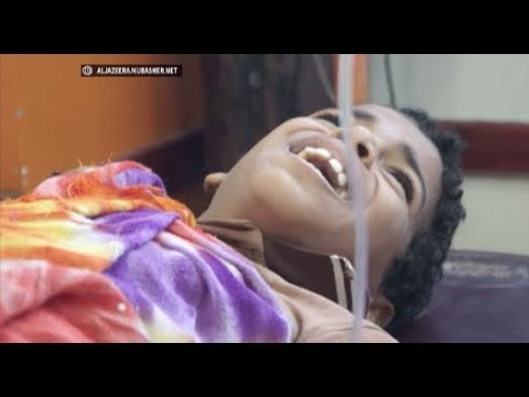 قذيفة حوثية تقتل طفلا وتصيب آخر من أسرة واحدة غربي تعز